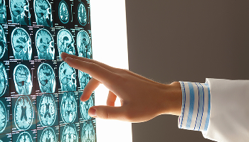 Brain & Spinal Cord Injuries